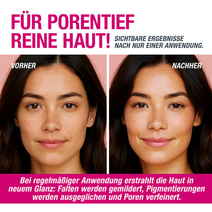 VAMPIRE PEEL® - FRUCHTSÄUREPEELING